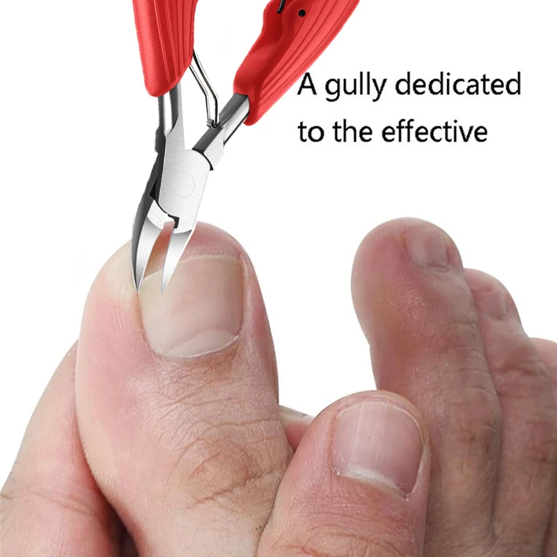 Cortauñas para uñas de los pies, cortador de uñas de acero inoxidable, profesional, paroniquia encarnada, piel muerta, herramientas de pedicura Cortauñas para uñas de los pies, cortador de uñas de acero inoxidable, profesional, paroniquia encarnada, piel muerta, herramientas de pedicura