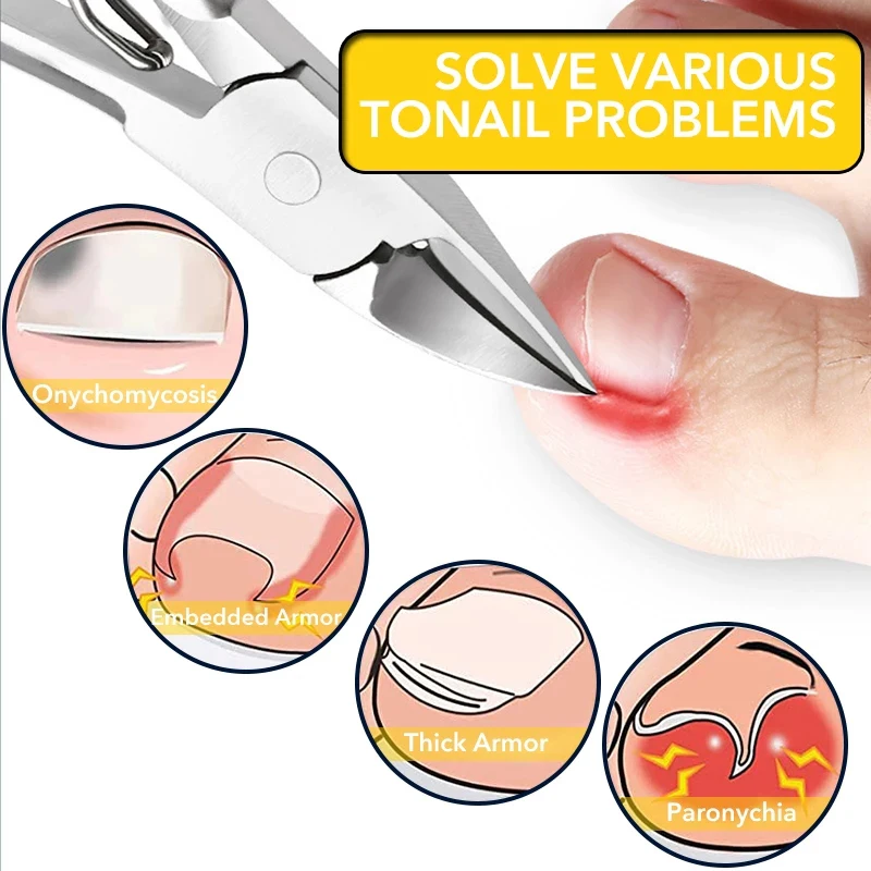 Cortauñas para uñas de los pies, cortador de uñas de acero inoxidable, profesional, paroniquia encarnada, piel muerta, herramientas de pedicura Cortauñas para uñas de los pies, cortador de uñas de acero inoxidable, profesional, paroniquia encarnada, piel muerta, herramientas de pedicura